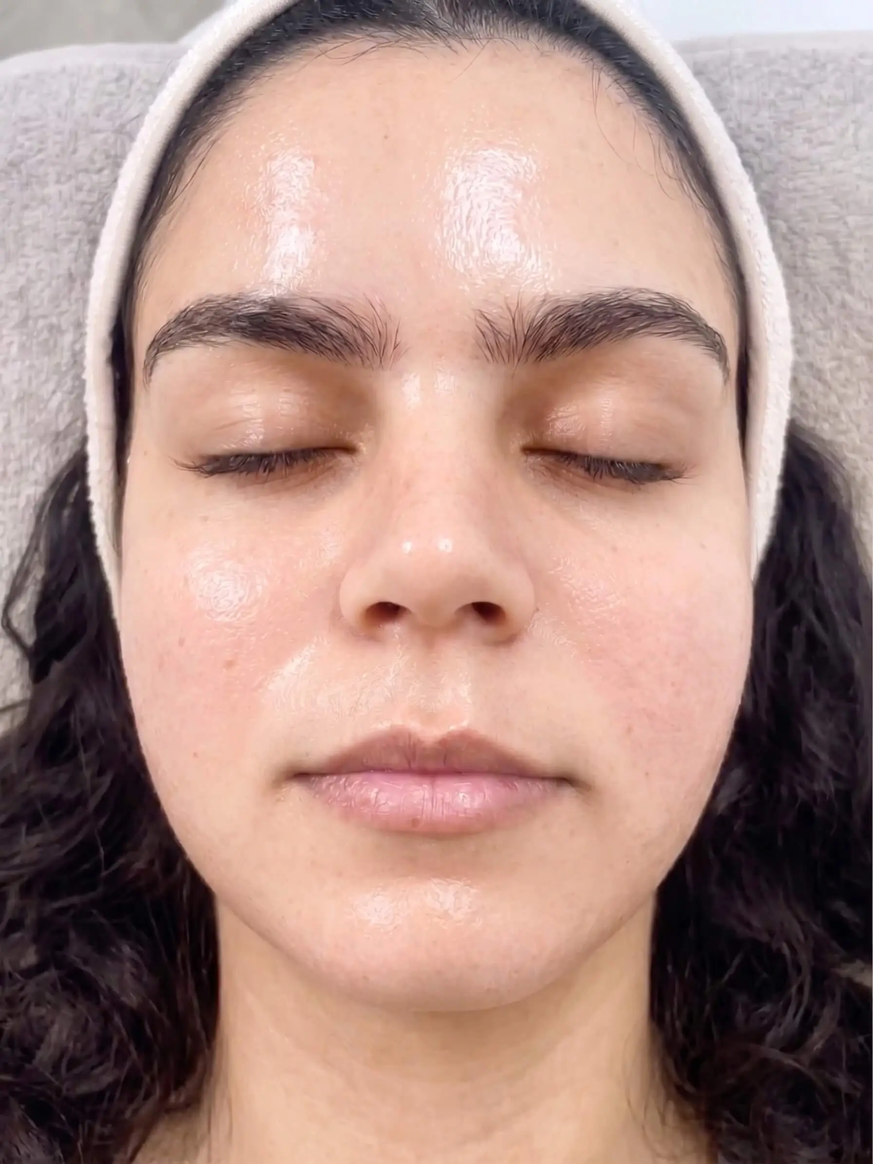 Après Hydrafacial Spécifique